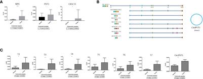 CASC11 and PVT1 spliced transcripts play an oncogenic role in colorectal carcinogenesis